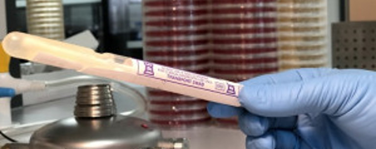 Sti Surveillance Test Esr