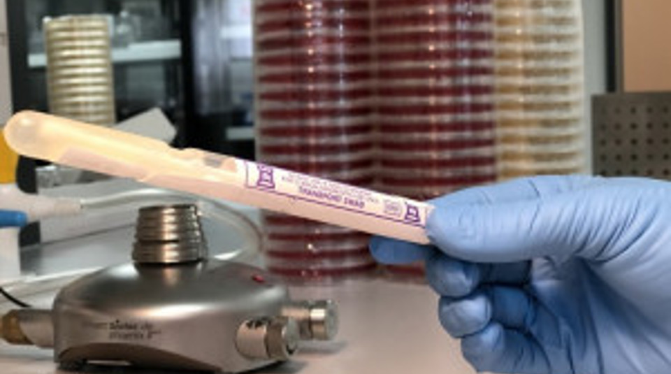 Sti Surveillance Test Esr