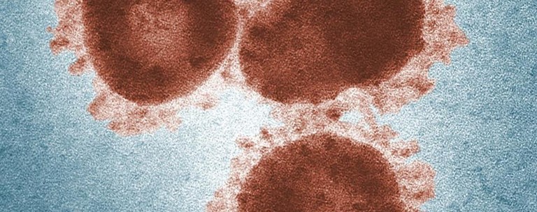 Virus Esr