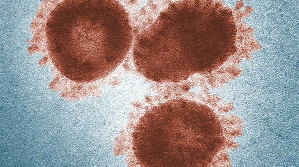Virus Esr