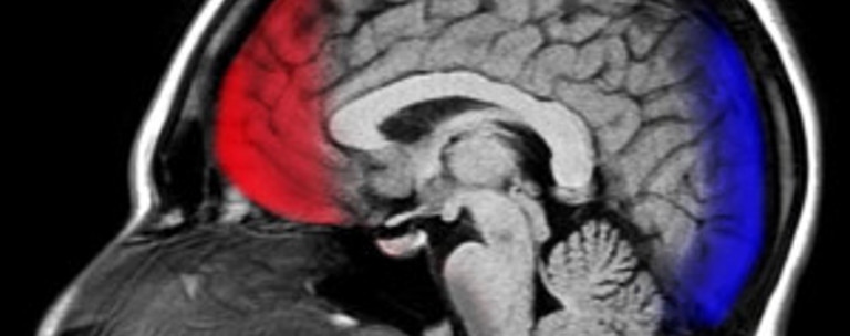 Concussion Fitwzmwmcwzmdbd 2018