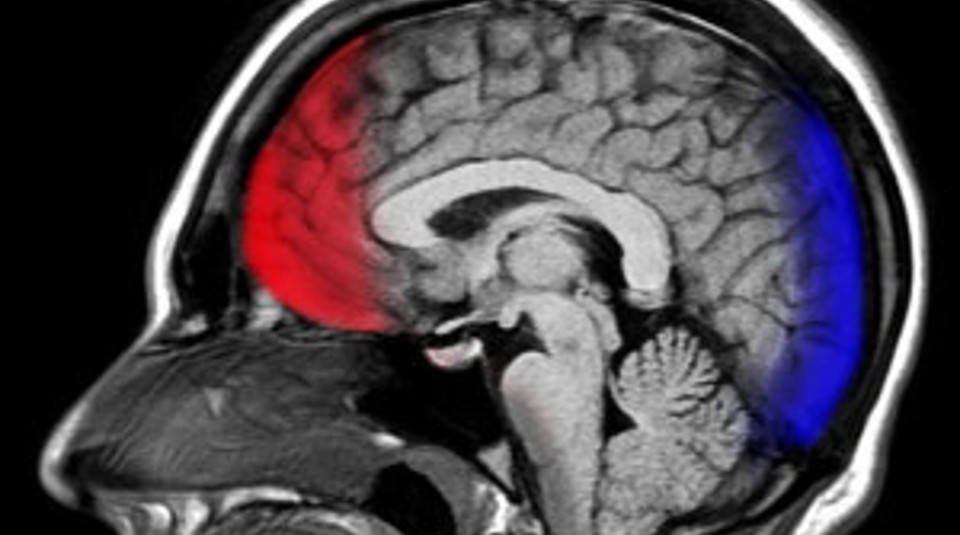 Concussion Fitwzmwmcwzmdbd 2018
