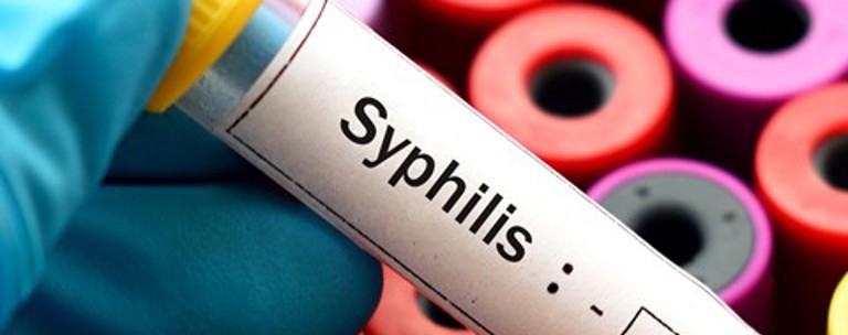 Syphilis Test Tube Sti Surveillance Esr