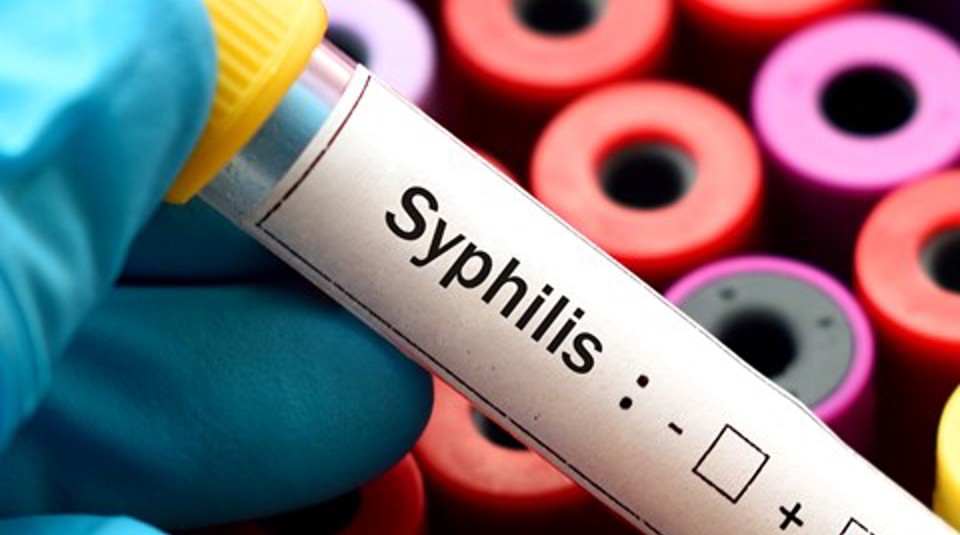 Syphilis Test Tube Sti Surveillance Esr