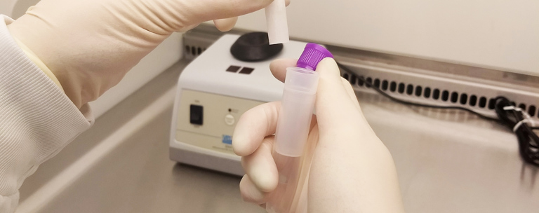 Saliva Collection Device ESR