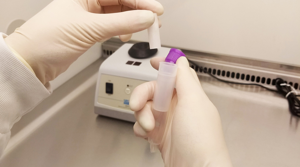 Saliva Collection Device ESR