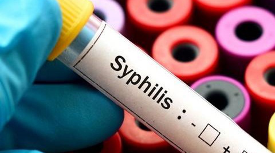 Syphilis